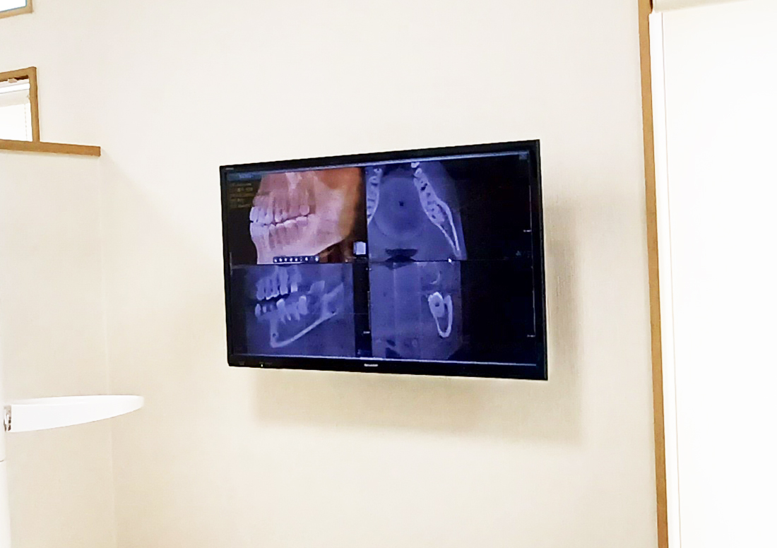 説明用モニター