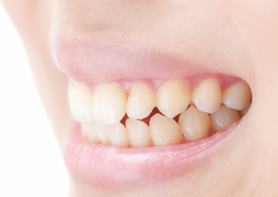 歯ぎしり・食いしばり