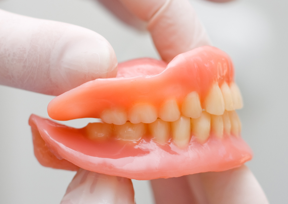 入れ歯（義歯）